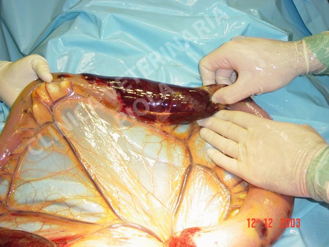 Infarto 1